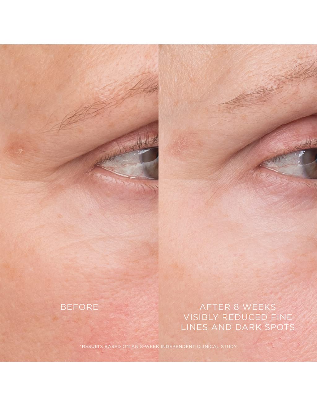 HOURGLASS EQUILIBRIO RESURFACING RETINOIDE TRATAMIENTO - 4