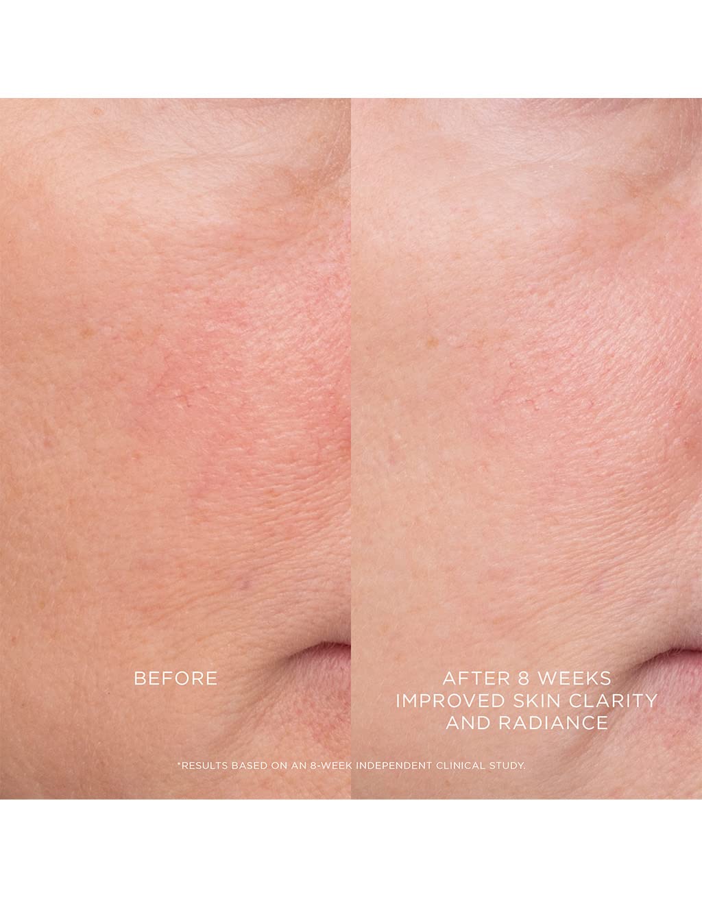 HOURGLASS EQUILIBRIO RESURFACING RETINOIDE TRATAMIENTO - 5