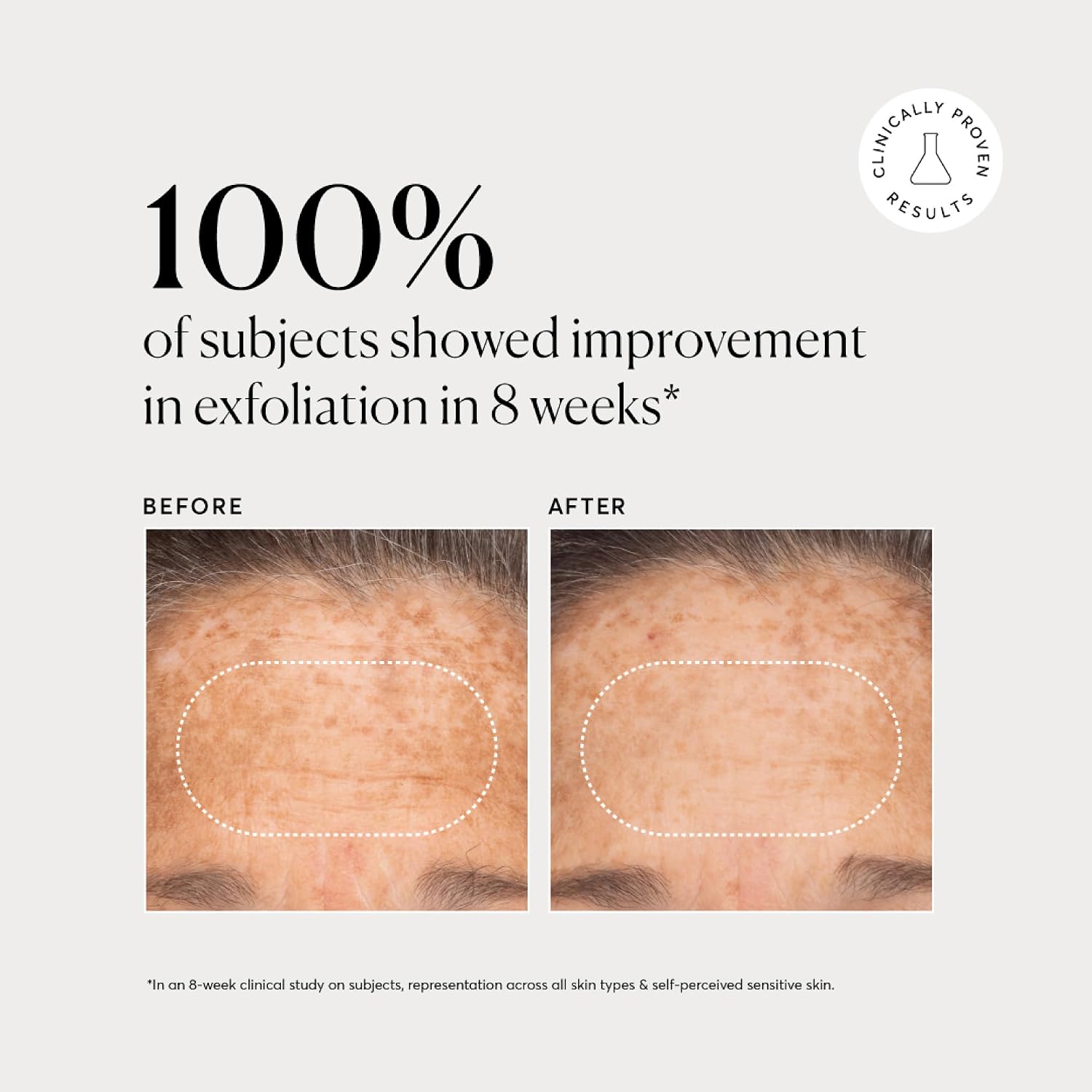 NATURIUM BHA EXFOLIANTE LÍQUIDO 2%, TRATAMIENTO EXFOLIANTE DE POROS LEAVE-ON PARA ROSTRO Y CUIDADO DE LA PIEL, CON ÁCIDO - 5