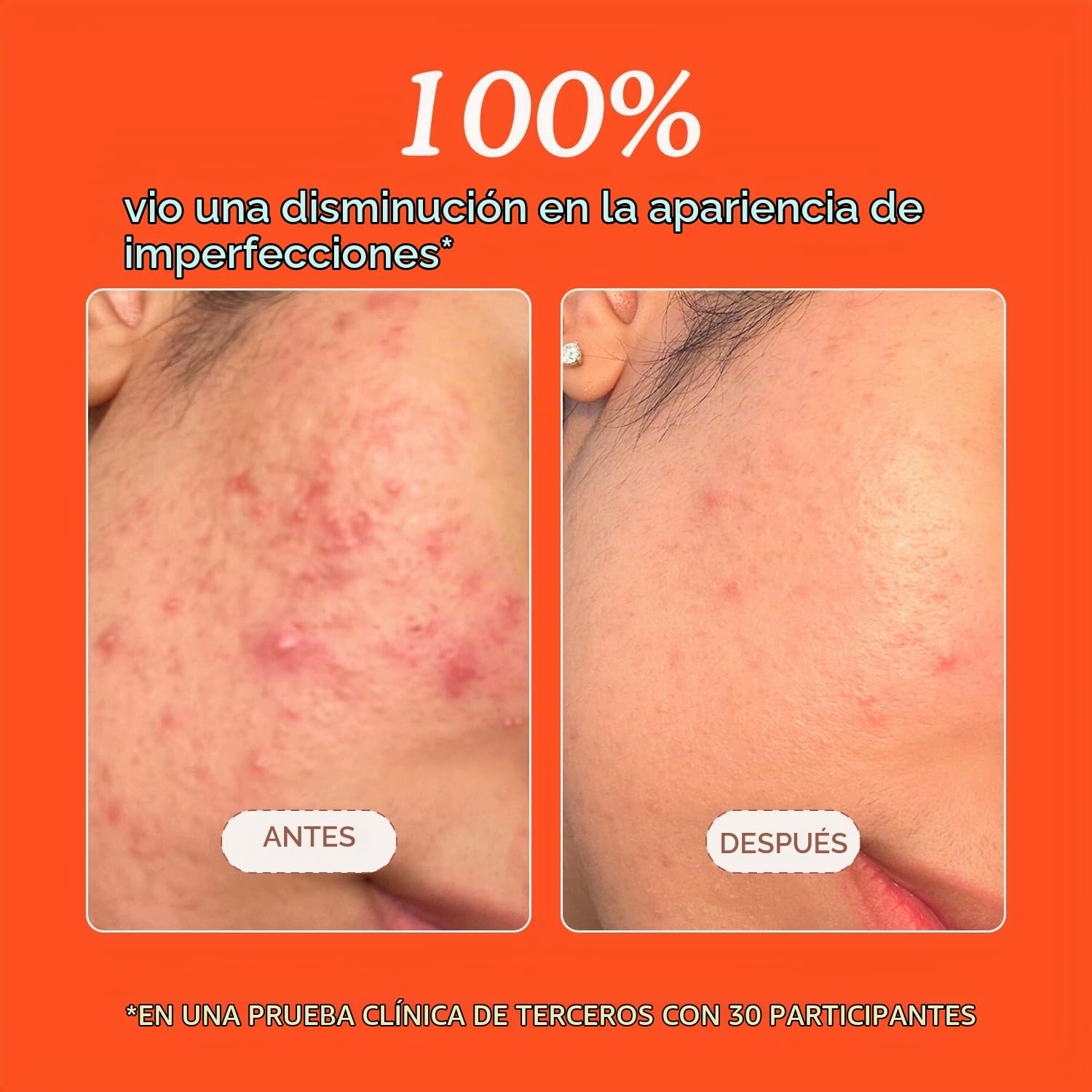 TOWER 28 SOS DAILY RESCUE SPRAY DE ÁCIDO HIPOCLOROSO CALMANTE PARA ROSTRO 1 OZ - 4