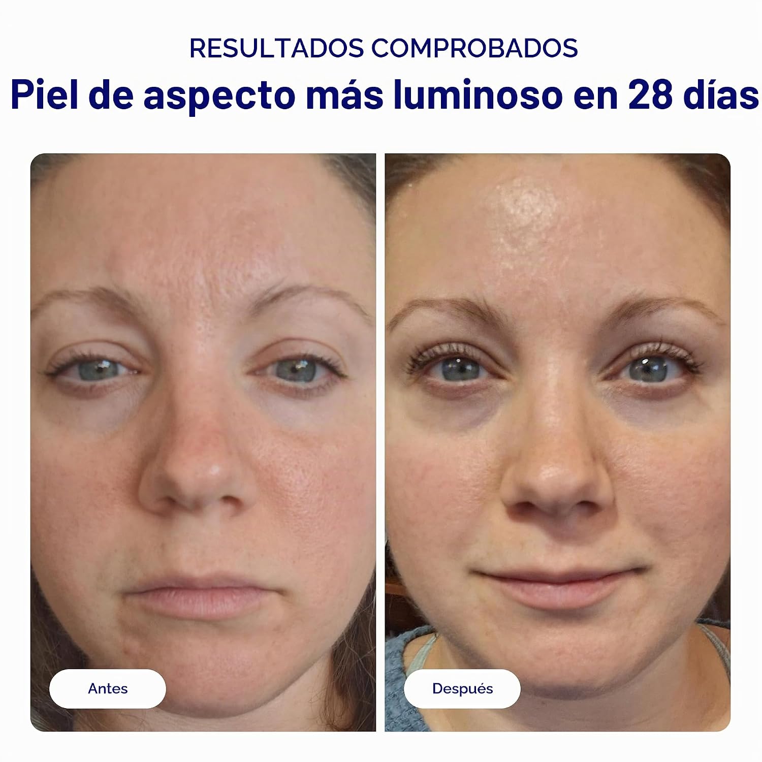 BLISS BRIGHT IDEA - SUERO FACIAL DE VITAMINA C Y TRI-PÉPTIDO, PROTEGE Y ILUMINA LA PIEL, REDUCE LAS MANCHAS OSCURAS - 2