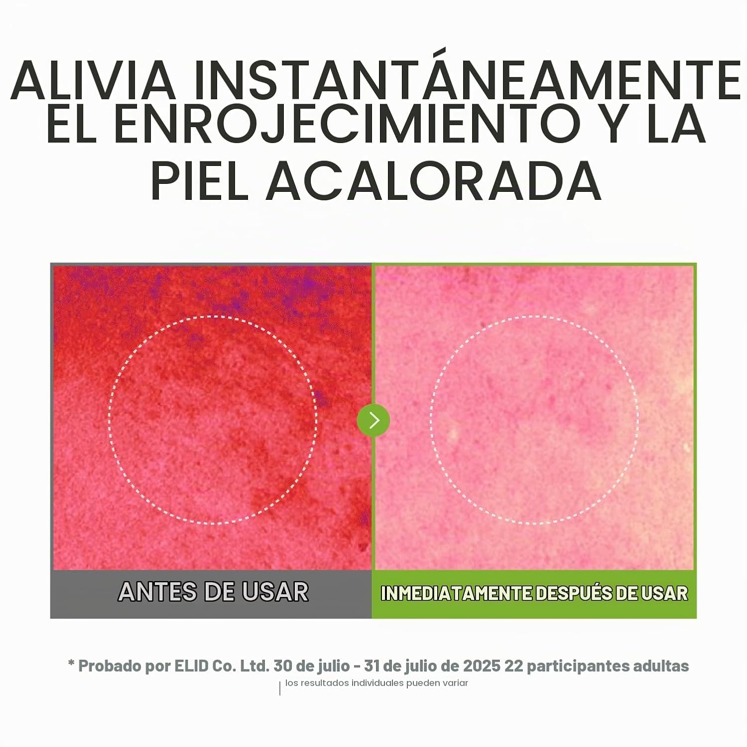 7 RELIEF - AMPOLLA FACIAL EN ESPRAY CUIDADO CALMANTE E HIDRATANTE INSTANTÁNEO CON EXTRACTOS PUROS DE CENTELLA PARA PIEL SECA - 5