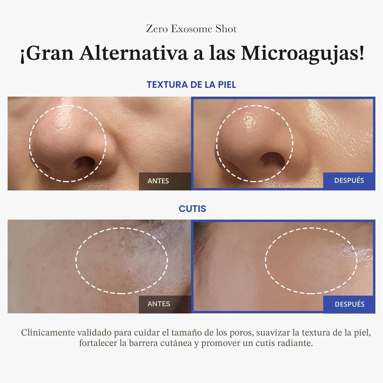 MEDICUBE ZERO EXOSOME SHOT 2,000 PPM ESPÍCULA SUERO FACIAL SUERO LÍQUIDO POTENCIADOR DE LA PIEL EXOSOMA, AHA BHA PHA CUIDADO - 3