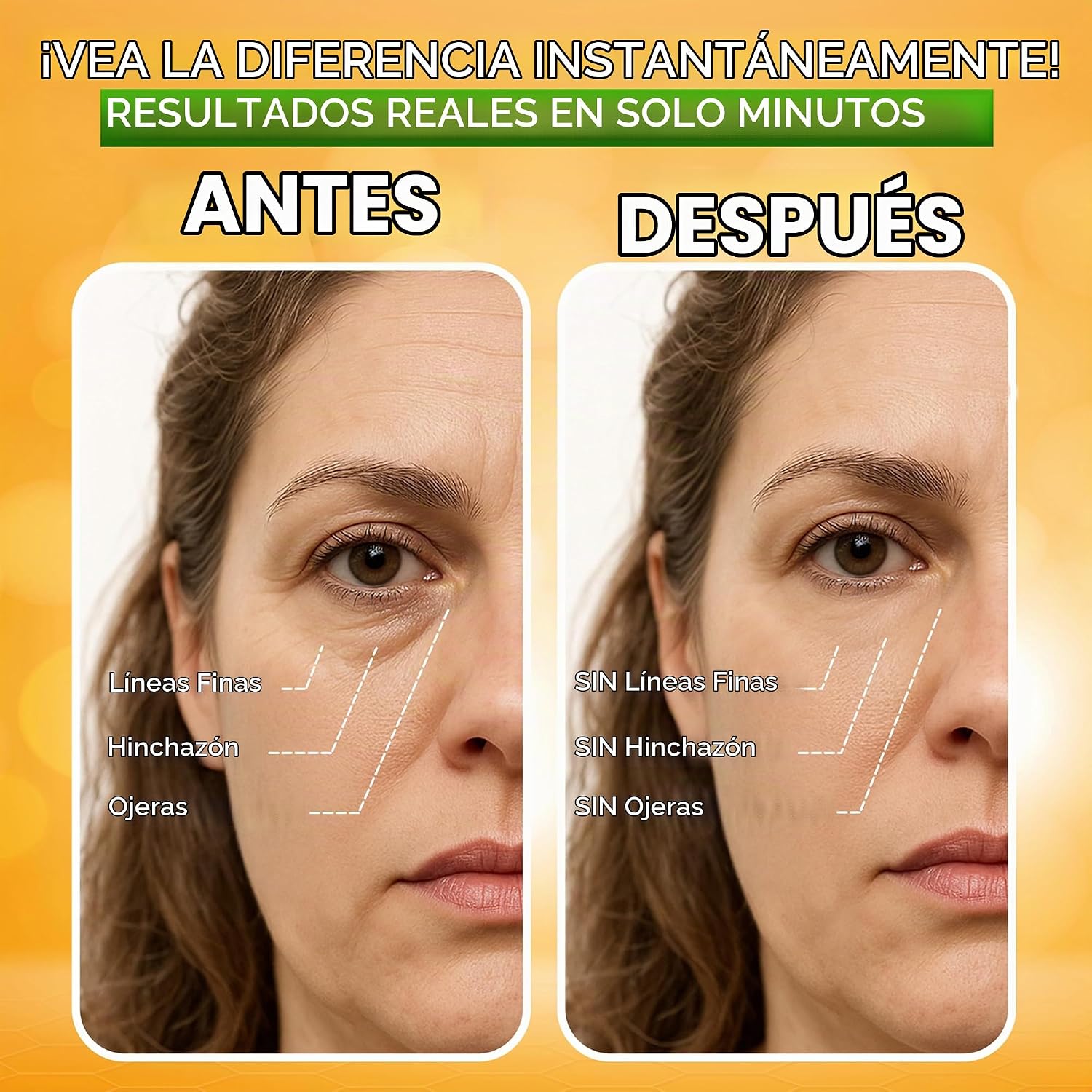 TRATAMIENTO PARA OJOS HINCHADOS RESULTADOS INSTANTÁNEOS ELIMINA NATURALMENTE ARRUGAS, HINCHAZÓN, OJERAS Y BOLSAS EN MINUTOS - 4