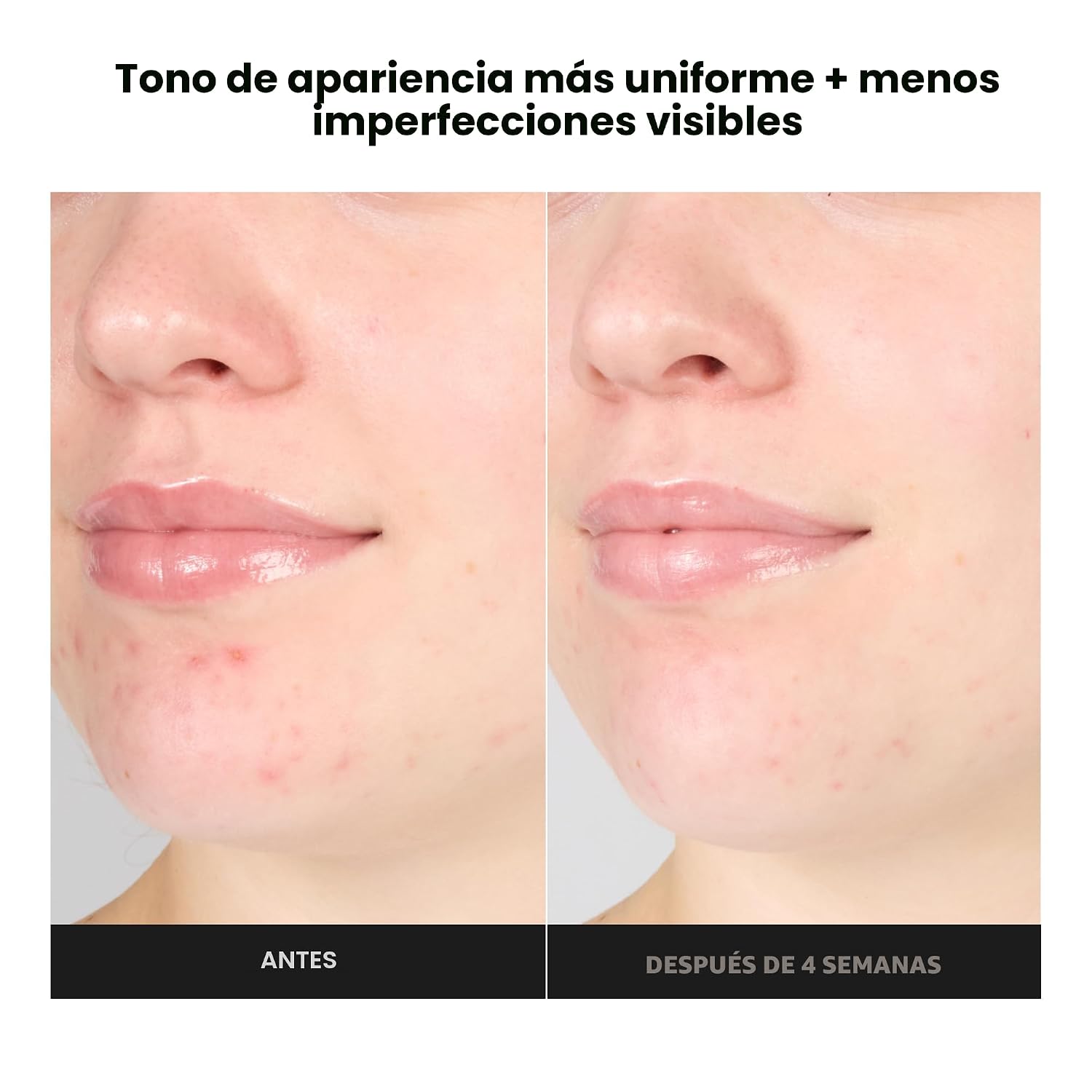 PAULA S CHOICE SKIN PERFECTING - TÓNICO DE GEL EXFOLIANTE 1% BHA, 3.3 ONZAS LÍQUIDAS - 2