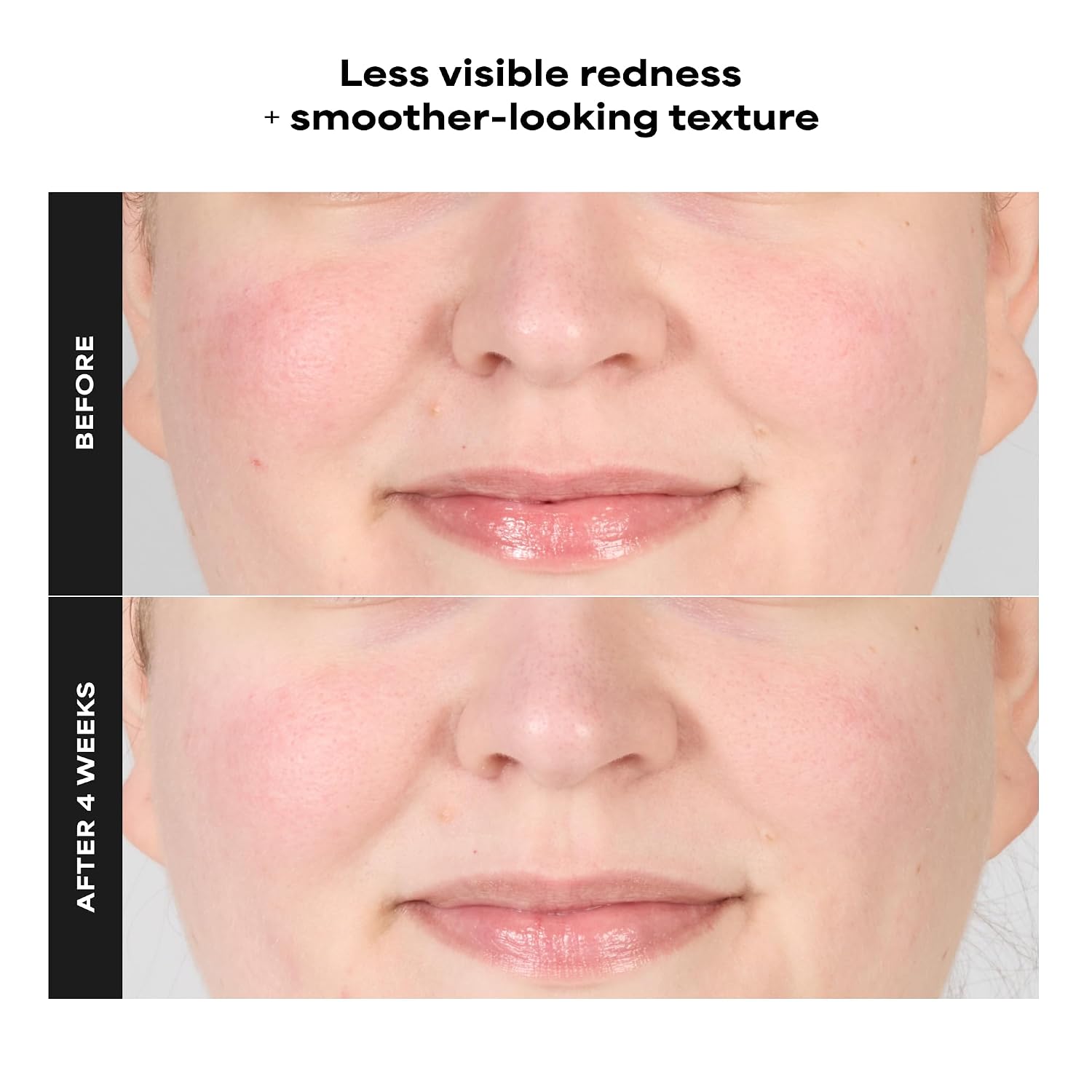 PAULA S CHOICE SKIN PERFECTING - TÓNICO DE GEL EXFOLIANTE 1% BHA, 3.3 ONZAS LÍQUIDAS - 3