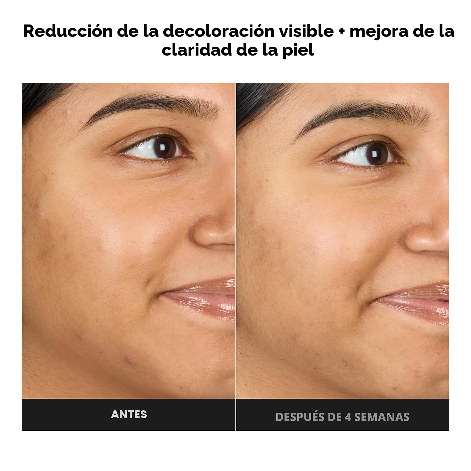 PAULA S CHOICE SKIN PERFECTING - TÓNICO DE GEL EXFOLIANTE 1% BHA, 3.3 ONZAS LÍQUIDAS - 4