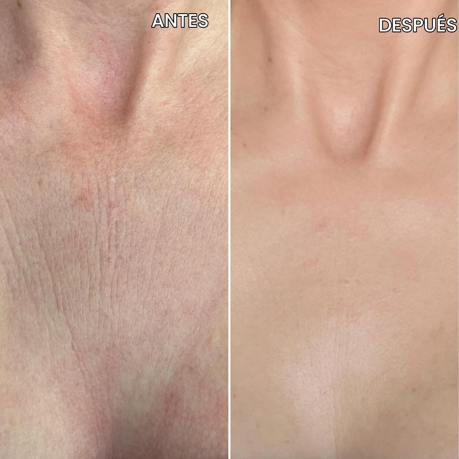 BEAUTY PIE BER YOUTH SPRAY PARA EL CUELLO Y EL PECHO SUERO ANTIENVEJECIMIENTO - 3