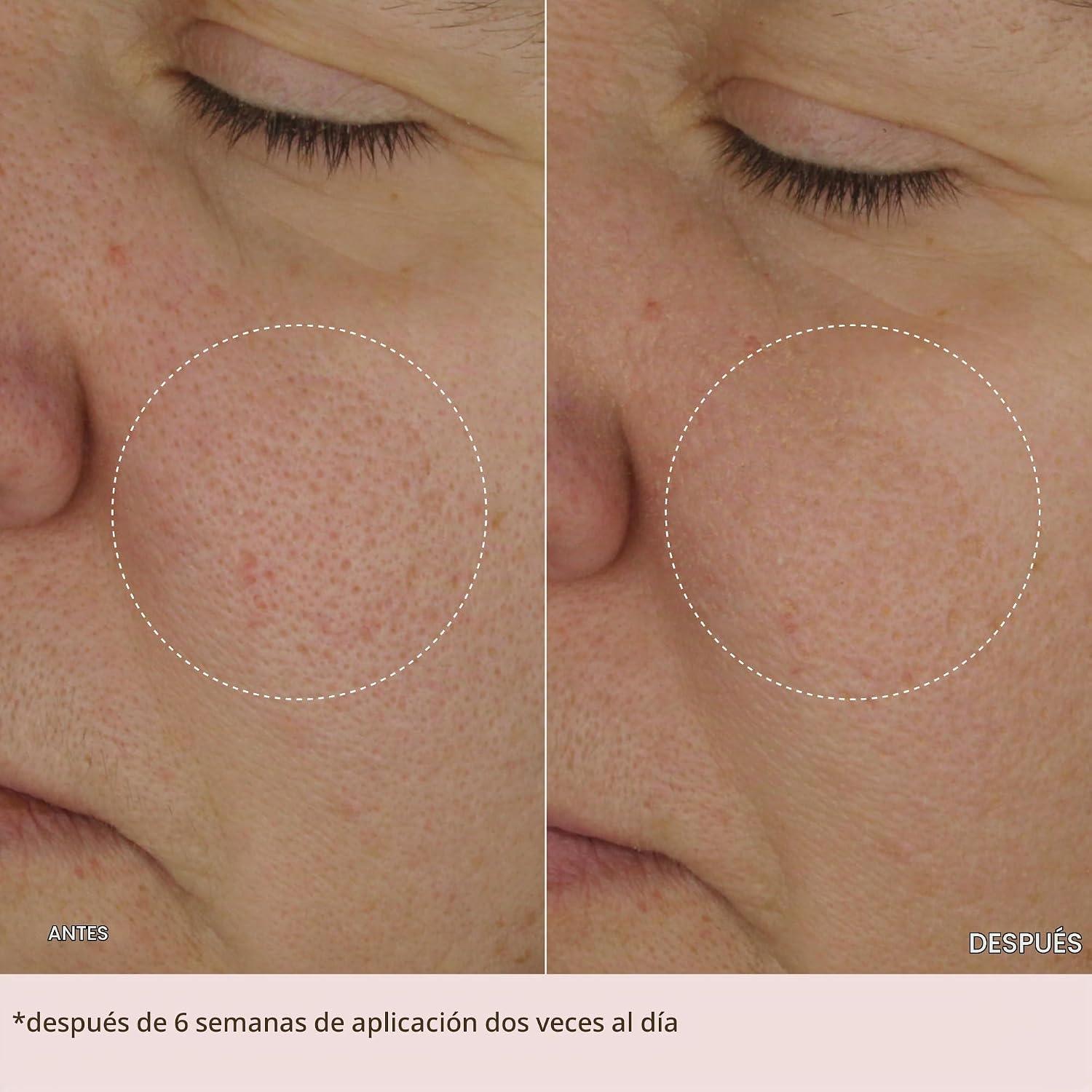 MZ SKIN THE LIGHT CREMA HIDRATANTE FACIAL CREMA FACIAL LIGERA ANTIENVEJECIMIENTO CON ÁCIDO HIALURÓNICO, PÉPTIDOS Y COLÁGENO - 7