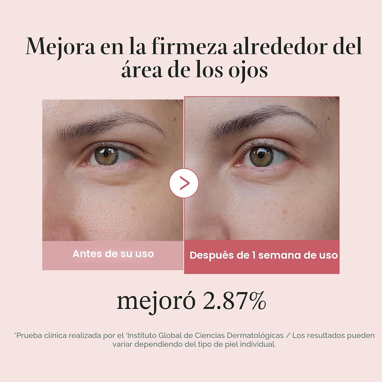 MEDICUBE SUERO DE OJOS CON PÉPTIDOS ROSA DE ADN DE SALMÓN PDRN CON NIACINAMIDA Y RETINOL DE PUREZA DEL 99% PARA LÍNEAS - 4