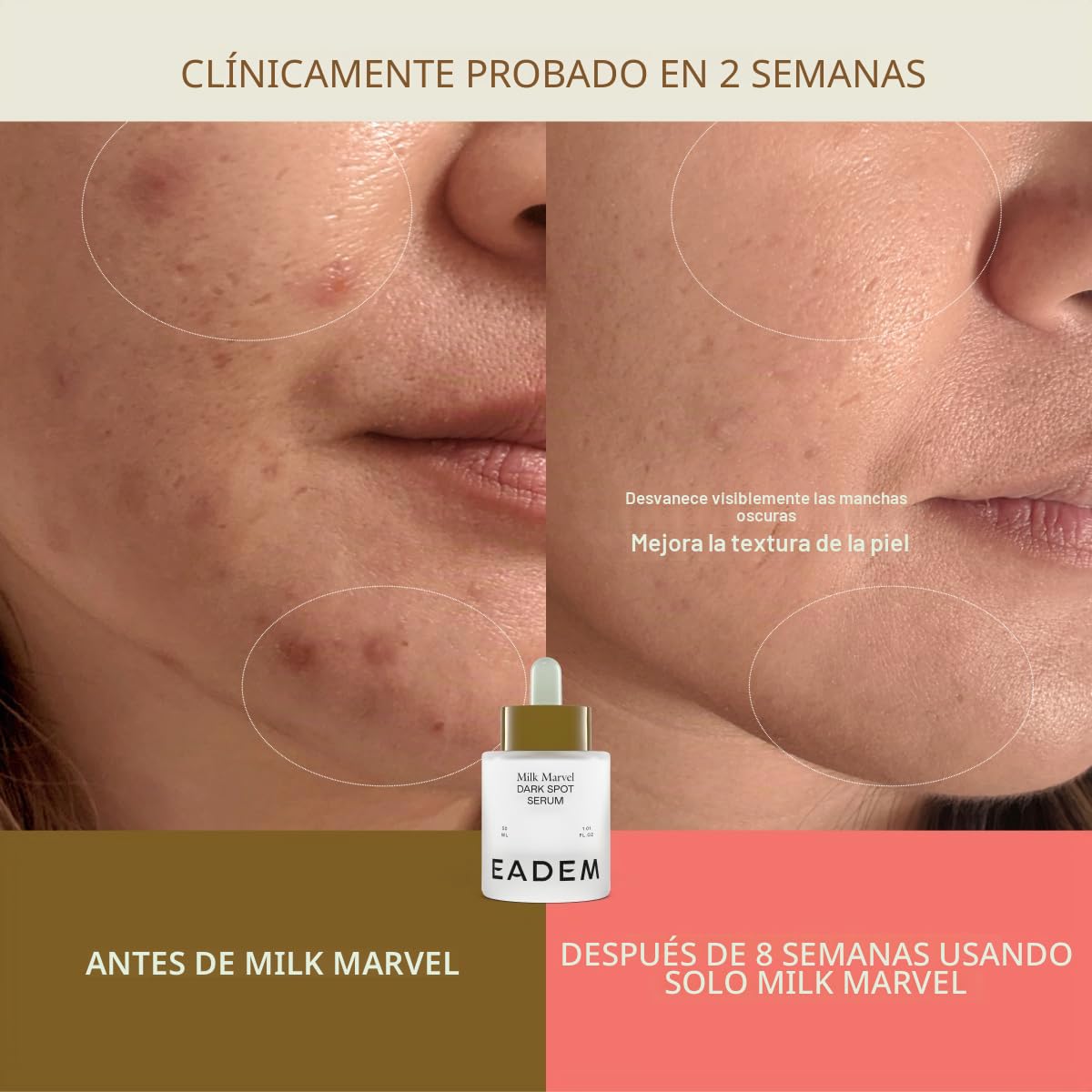 EADEM SUERO REMOVEDOR DE MANCHAS OSCURAS PARA LA CARA INFUNDIDO CON VITAMINA C Y NIACINAMIDA - 3