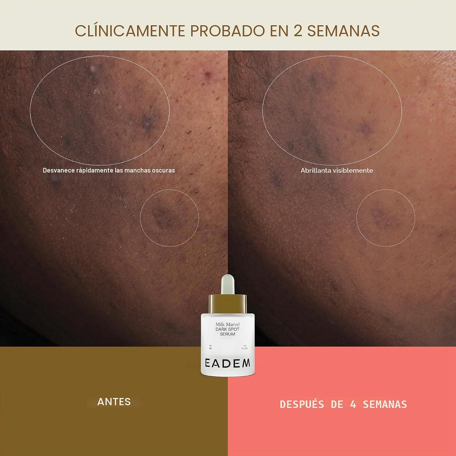 EADEM SUERO REMOVEDOR DE MANCHAS OSCURAS PARA LA CARA INFUNDIDO CON VITAMINA C Y NIACINAMIDA - 4
