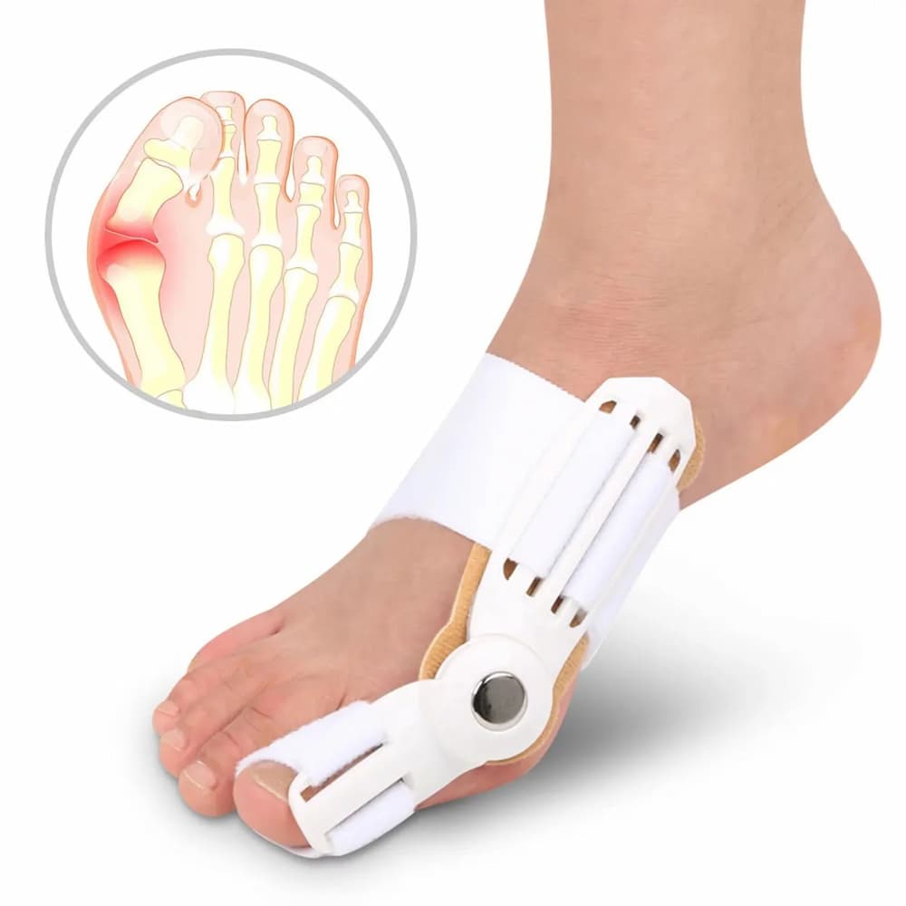 CORRECTOR DE JUANETE HALLUX VALGUS AJUSTABLE PARA PIE - 1