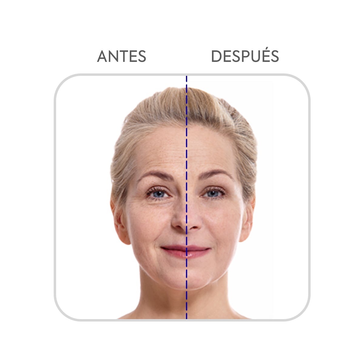 QUALITY PRODUCTS LISHÉ CREMA FACIAL ANTENÚA LINEAS DE EXPRESIÓN 103468 - 2