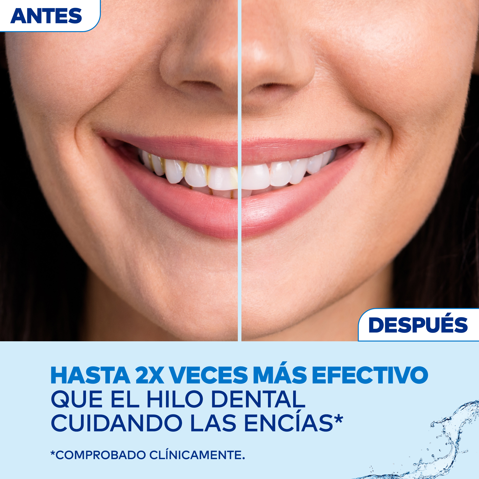 IRRIGADOR BUCAL WATERPIK CORDLESS PLUS WP 490 INALÁMBRICO RECARGABLE 2 NIVELES DE PRESIÓN BLANCO - 6
