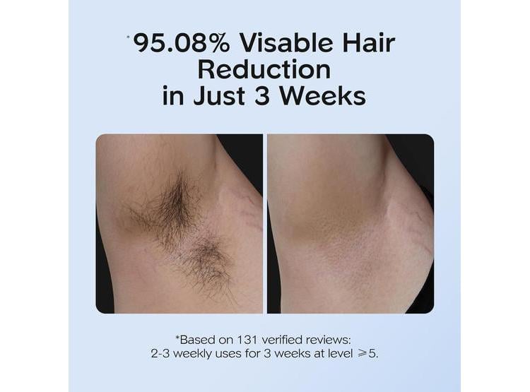 DEPILADORA IPL INNZA CON CUIDADO DE ENFRIAMIENTO POR HIELO, 999,999 FLASHES, SIN DOLOR Y RESULTADOS DURADEROS - 2
