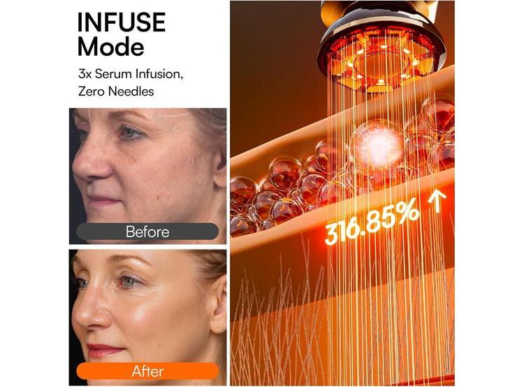 TERAPIA DE LUZ ROJA 3 EN 1 INIA, DISPOSITIVO PARA LIFTING, REAFIRMACIÓN E INFUSIÓN DE LA PIEL EN ROSTRO Y CUELLO - 6