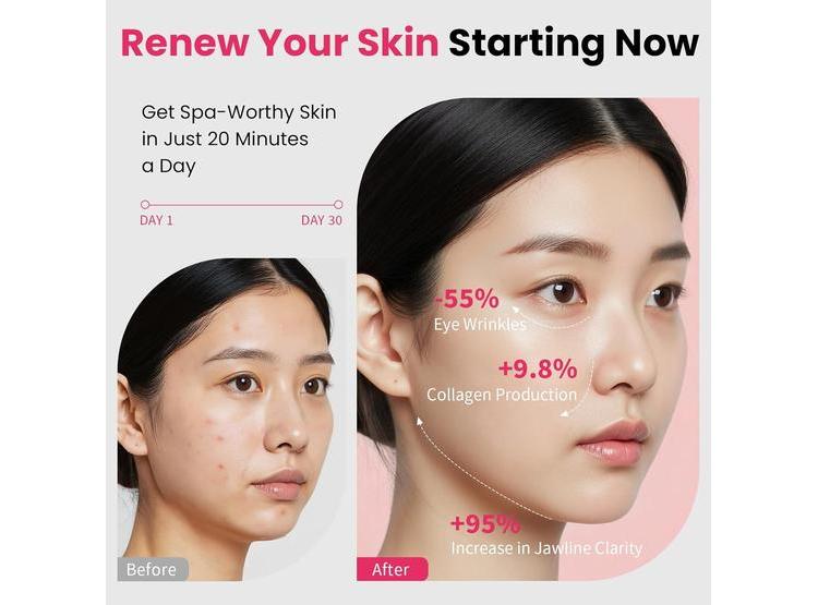 DISPOSITIVO FACIAL 8 EN 1 PARA ESTIRAMIENTO Y LIFTING MAGIVOL - 2