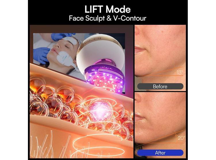 DISPOSITIVO FACIAL MICROCORRIENTE 8 EN 1 INIA SPHERA CON LUZ ROJA Y MODOS PERSONALIZADOS PARA CUIDADO EN CASA - 4