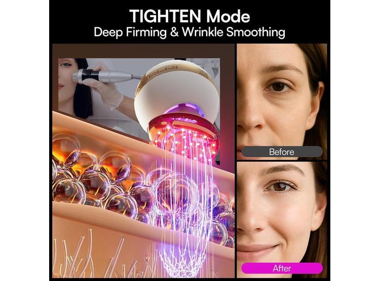 DISPOSITIVO FACIAL MICROCORRIENTE 8 EN 1 INIA SPHERA CON LUZ ROJA Y MODOS PERSONALIZADOS PARA CUIDADO EN CASA - 5