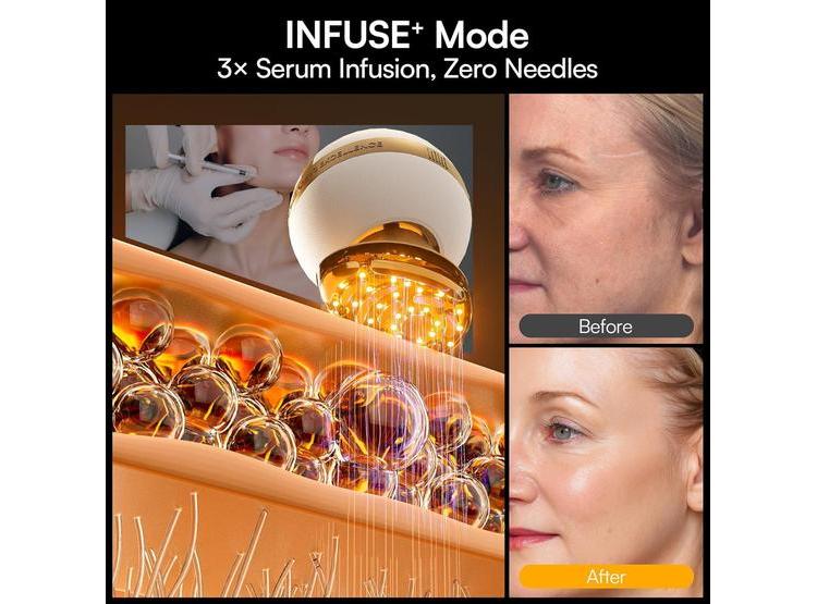 DISPOSITIVO FACIAL MICROCORRIENTE 8 EN 1 INIA SPHERA CON LUZ ROJA Y MODOS PERSONALIZADOS PARA CUIDADO EN CASA - 6
