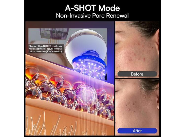 DISPOSITIVO FACIAL MICROCORRIENTE 8 EN 1 INIA SPHERA CON LUZ ROJA Y MODOS PERSONALIZADOS PARA CUIDADO EN CASA - 7