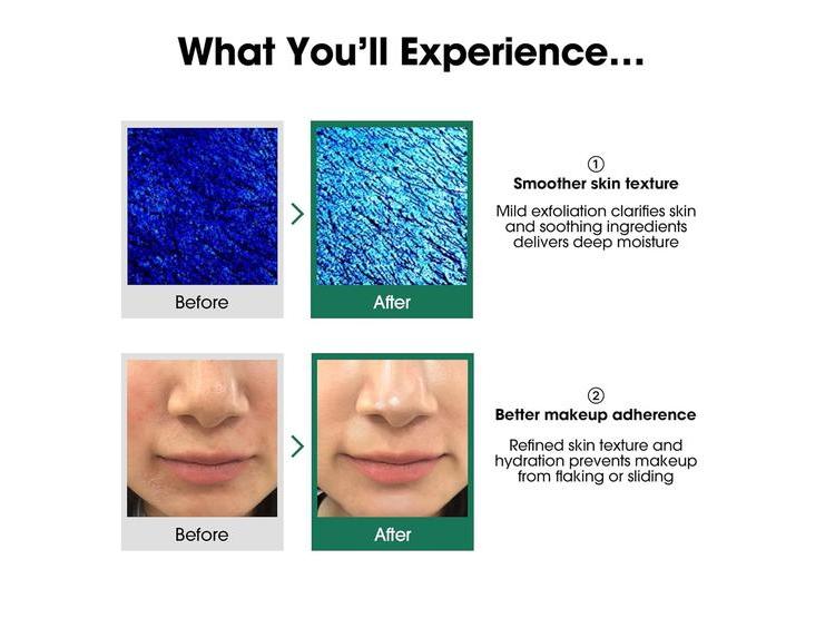 TÓNICO FACIAL EXFOLIANTE SOME BY MI 150ML - 4