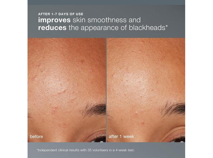 DERMALOGICA EXFOLIANTE FACIAL CON ÁCIDO SALICÍLICO Y PAPAYA 13G - 2