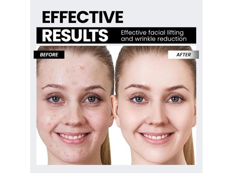 DISPOSITIVO FACIAL DE MICROCORRIENTE CON LUZ ROJA PARA LEVANTAR Y TENSAR LA PIEL, REDUCE ARRUGAS Y SIGNOS DE EDAD - 3