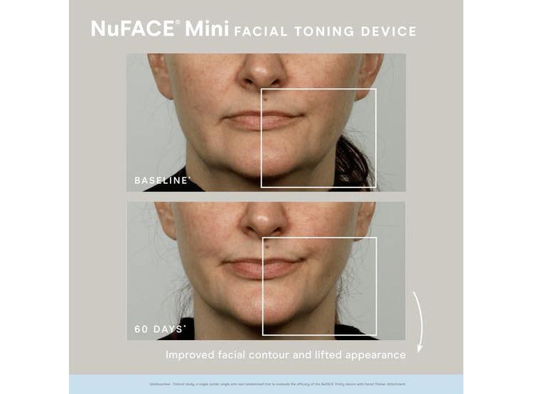 DISPOSITIVO NUFACE MINI PARA CONTORNO Y REDUCCIÓN DE LÍNEAS - 4