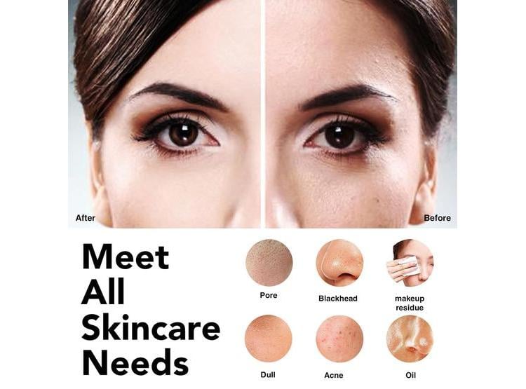 NÅGRACOOLA CLIE CEPILLO FACIAL ELÉCTRICO RECARGABLE, IMPERMEABLE, PARA LIMPIEZA, EXFOLIACIÓN Y MASAJE - 3