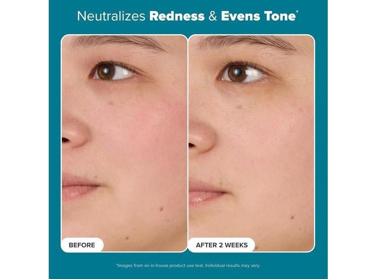 TÓNICO FACIAL PAULA'S CHOICE NIACINAMIDA POROS GRASA - 2