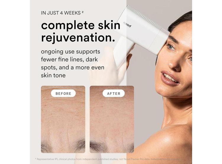 NOOD FLASHER PRO: DEPILACIÓN LÁSER IPL Y TERAPIA ANTI-EDAD SEGURA PARA HOMBRES Y MUJERES, RESULTADOS VISIBLES AL INSTANTE - 3