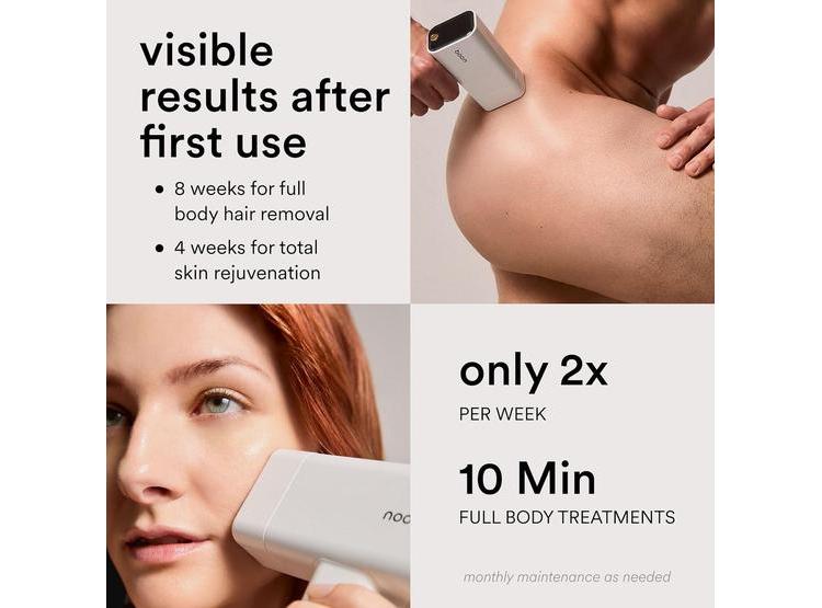 NOOD FLASHER PRO: DEPILACIÓN LÁSER IPL Y TERAPIA ANTI-EDAD SEGURA PARA HOMBRES Y MUJERES, RESULTADOS VISIBLES AL INSTANTE - 6