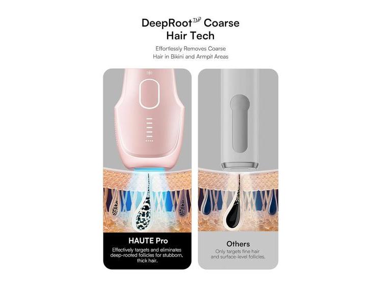 INIA DEPILADOR LÁSER IPL CON ENFRIAMIENTO PARA VELLO GRUESO EN EL CUERPO Y BIKINI PARA USO DOMÉSTICO - 3