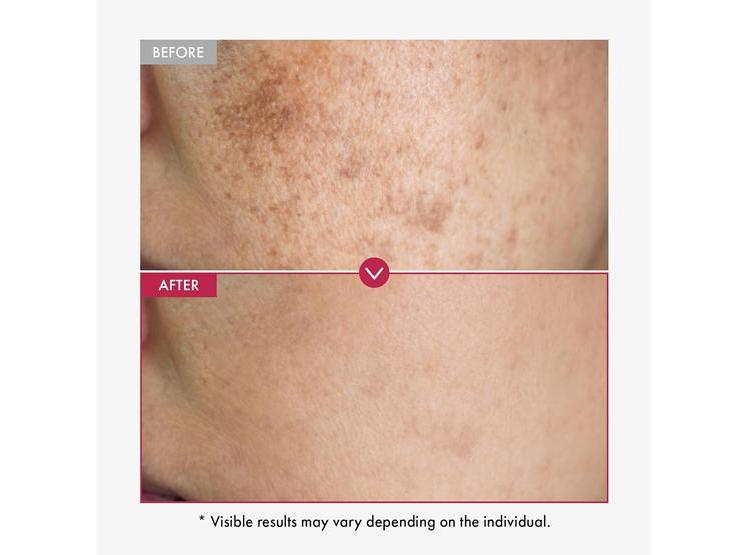 SUERO FACIAL DE NIACINAMIDA, ÁCIDO TRANEXÁMICO Y ARBUTINA, HIDRATANTE Y CLARIFICANTE DE PIEL TOSOWOONG 33ML - 2