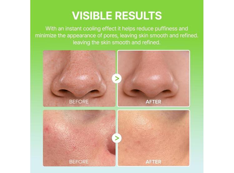 DR.MELAXIN CACTOX PORE RELIEF MULTI BALM STICK ENFRIAMIENTO, APRIETA POROS, REDUCE PIEL HINCHADA AL INSTANTE - 5