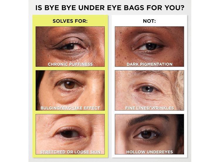 IT COSMETICS BYE BYE TRATAMIENTO PARA BOLSAS Y CORRECTOR DE OJOS, EFECTO RÁPIDO - 3