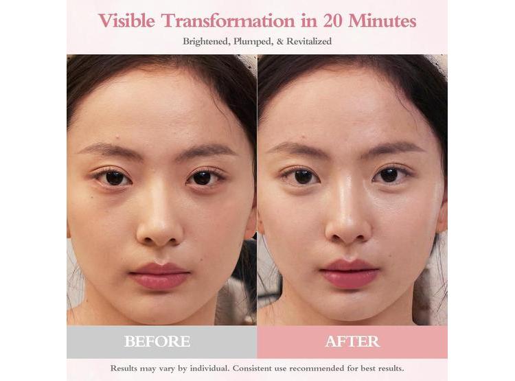 PDRN PARCHES PARA OJOS CON ADN DE SALMÓN, REDUCE ARRUGAS Y OJERAS, 60 UNIDADES - 2