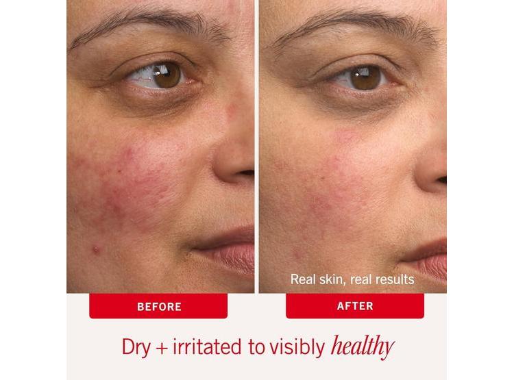 FIRST AID BEAUTY CREMA HIDRATANTE ULTRA REPARADORA AVENA COLOIDAL 177ML - 3