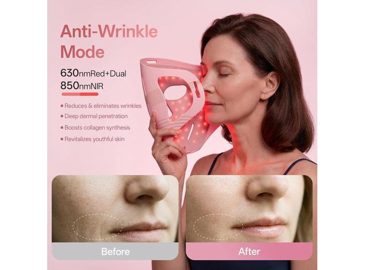 TERAPIA DE LUZ ROJA PROFESIONAL MASCARILLA LED 4D INALÁMBRICA GRAART - 2
