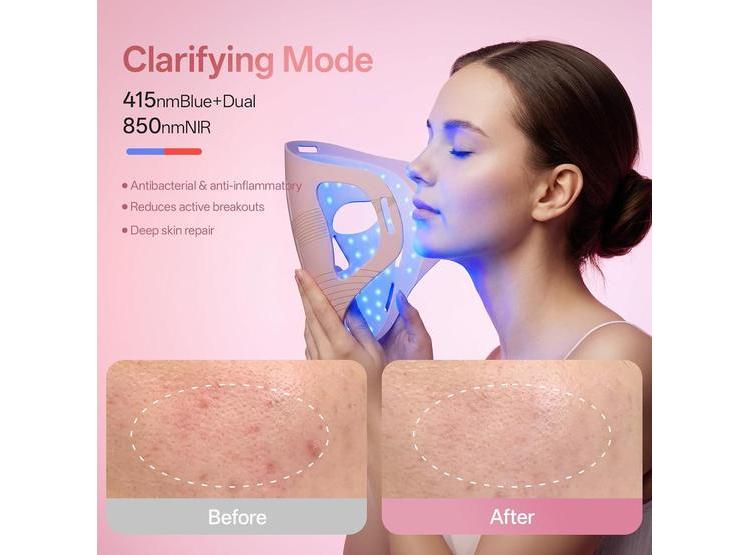 TERAPIA DE LUZ ROJA PROFESIONAL MASCARILLA LED 4D INALÁMBRICA GRAART - 3