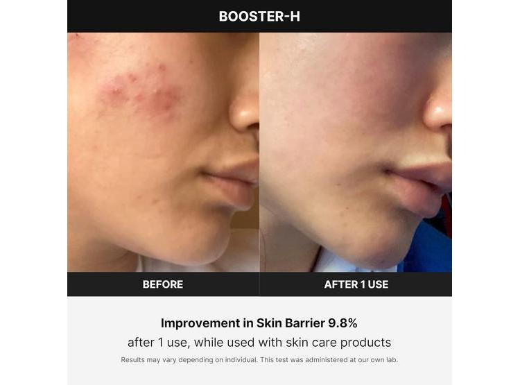 MEDICUBE BOOSTER H - HERRAMIENTA COREANA PARA BRILLO FACIAL Y ABSORCIÓN ÓPTIMA DEL CUIDADO DE LA PIEL - 3