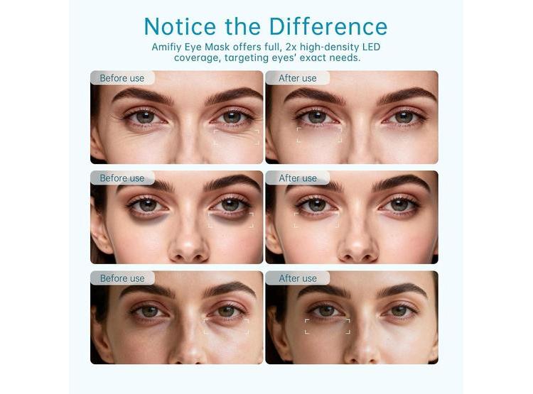 MÁSCARA DE OJOS LUZ ROJA INFRARROJA PARA OJERAS, ARRUGAS Y BOLSAS - 3