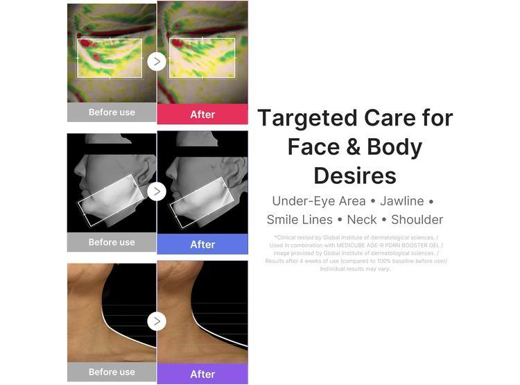 MEDICUBE MINI BOOSTER PRO PLUS, DISPOSITIVO 3 EN 1 COREANO PARA LIMPIEZA, CUIDADO DE PIEL Y CUERPO - 6