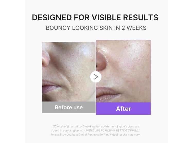 MEDICUBE MINI BOOSTER PRO PLUS, DISPOSITIVO FACIAL PORTÁTIL PARA CUIDADO DE LA PIEL RADIANTE, CALMANTE Y REBOTANTE - 3