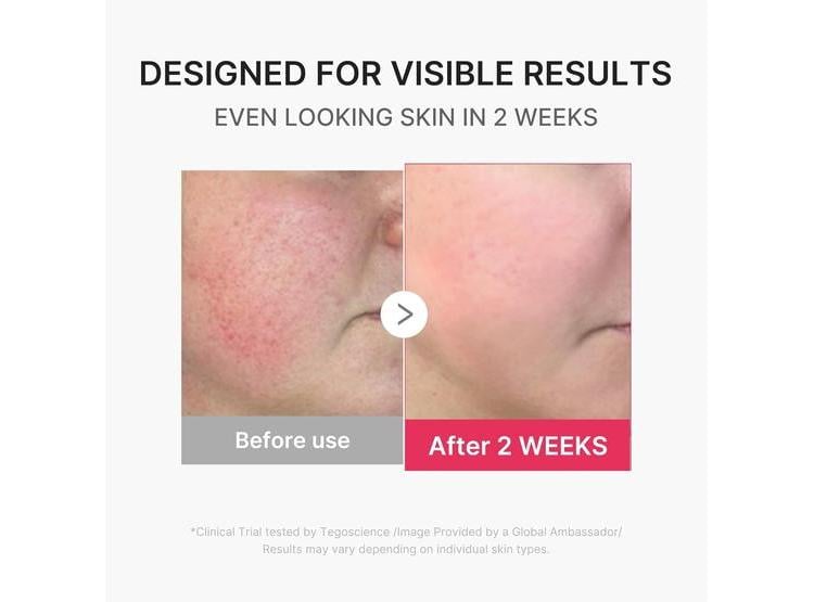 MEDICUBE MINI BOOSTER PRO PLUS, DISPOSITIVO FACIAL PORTÁTIL PARA CUIDADO DE LA PIEL RADIANTE, CALMANTE Y REBOTANTE - 4