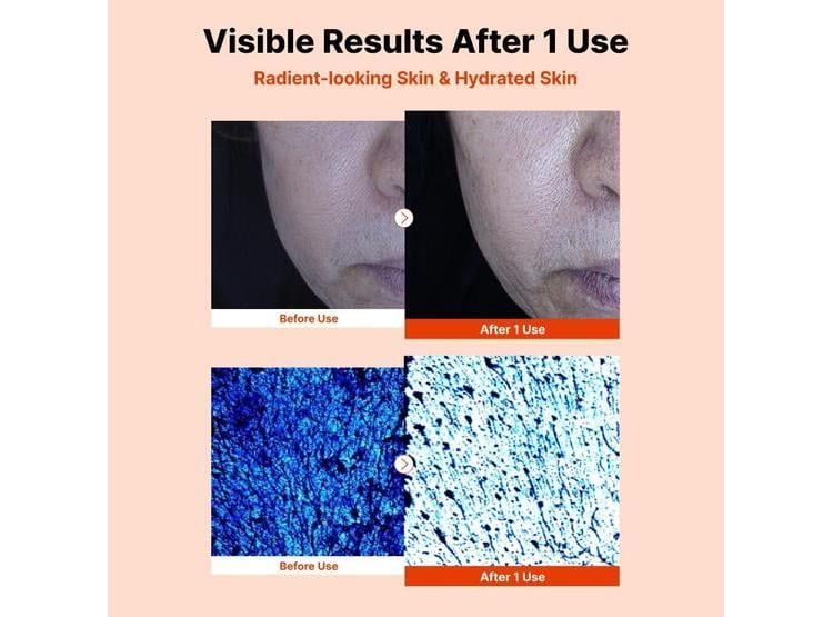 NIDA SERUM FACIAL CON PDRN, PÉPTIDOS, ADENOSINA, CAFEÍNA PARA HIDRATACIÓN INTENSA 50ML - 3