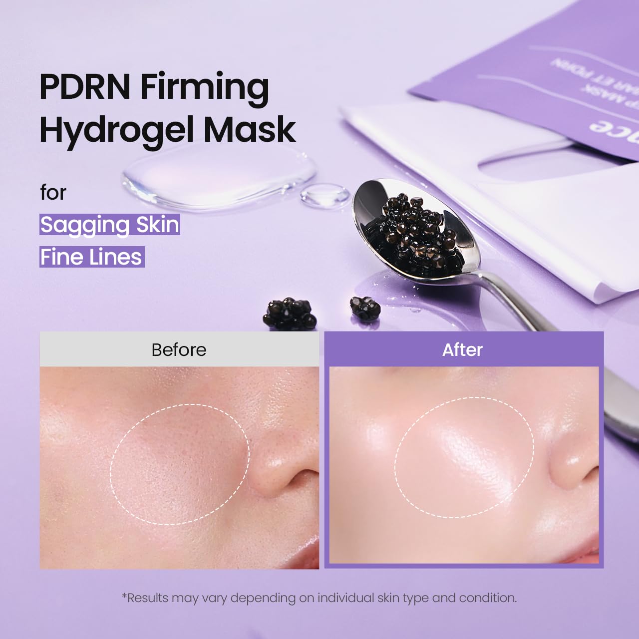 MASCARILLA FACIAL BIODANCE REJUVENATING CAVIAR PDRN REAL DEEP MASK HIDROGEL 34G X 4 UNIDADES - 3