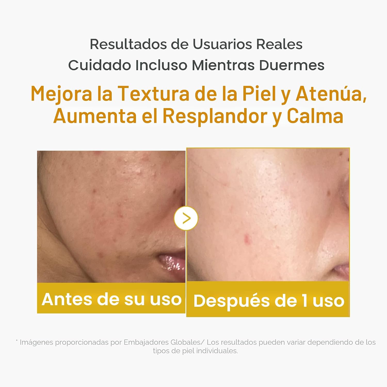 MASCARILLA FACIAL MEDICUBE WRAPPING MASK ÁCIDO KÓJICO Y CÚRCUMA DESPEGABLE - 5